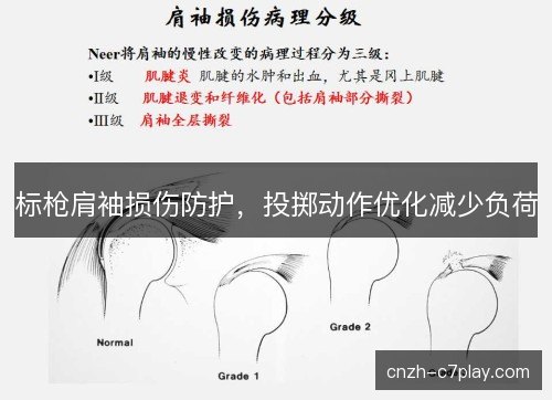 标枪肩袖损伤防护,投掷动作优化减少负荷 标枪肩袖损伤防护,投掷动作优化减少负荷